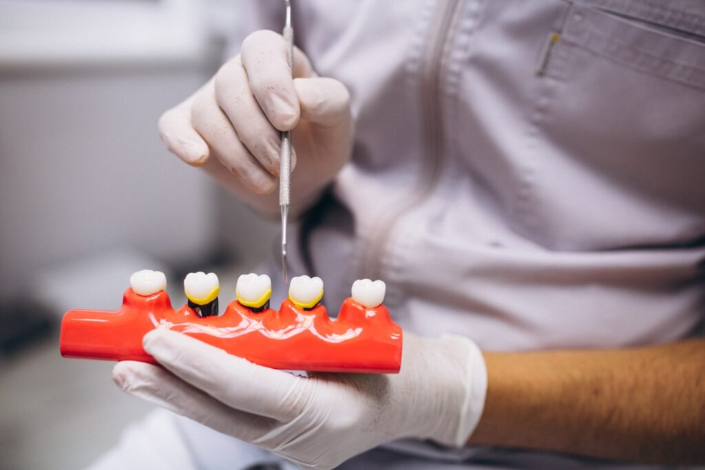 Dental Crown Process