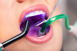 cosmetic dentistry treatments